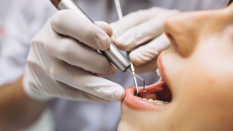 zubný implantát
