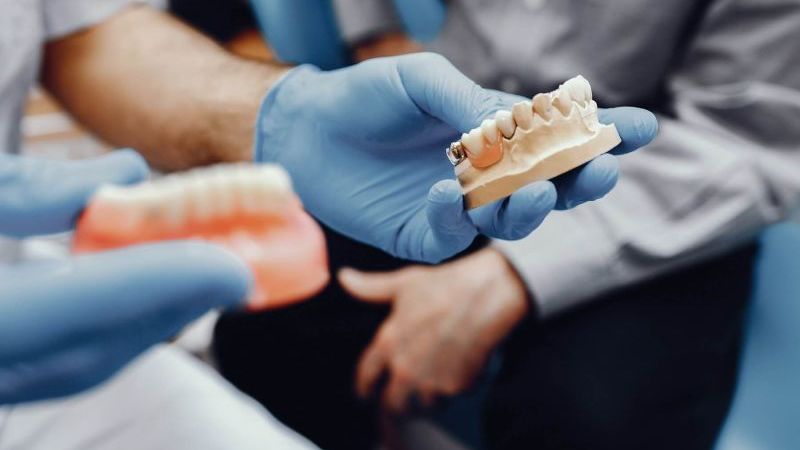 zubný implantát